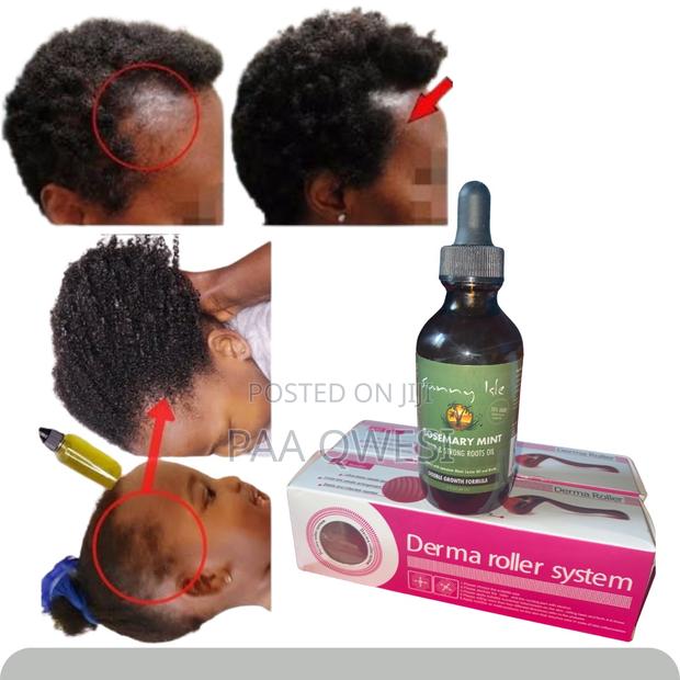Perfect Combo for Hair Regrowth · Photo 1