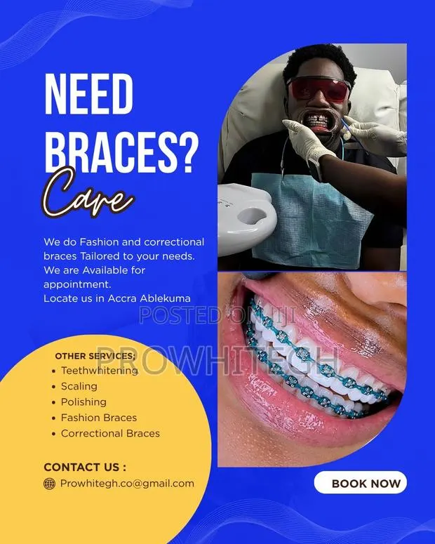 Braces /Fashion Braces · Photo 1