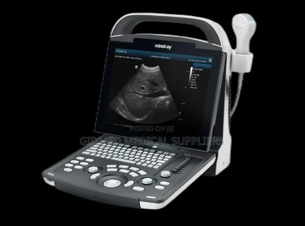 Ultrasound Machine Dp 10 · Photo 1