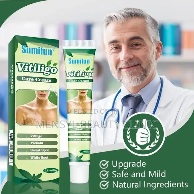 Vitiligo Cream Reduces White Spots on Skin · Photo 1