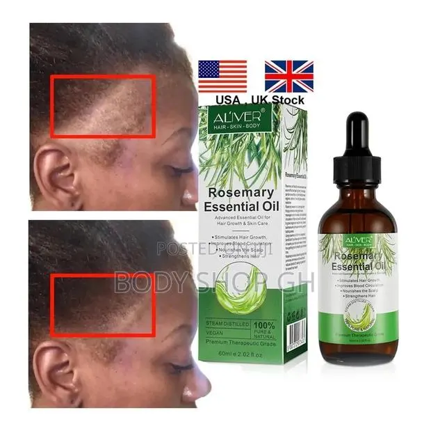 Rosemary Oil for Hair Growth, Eyebrow, Eyelash, Beard, Edges · Photo 1