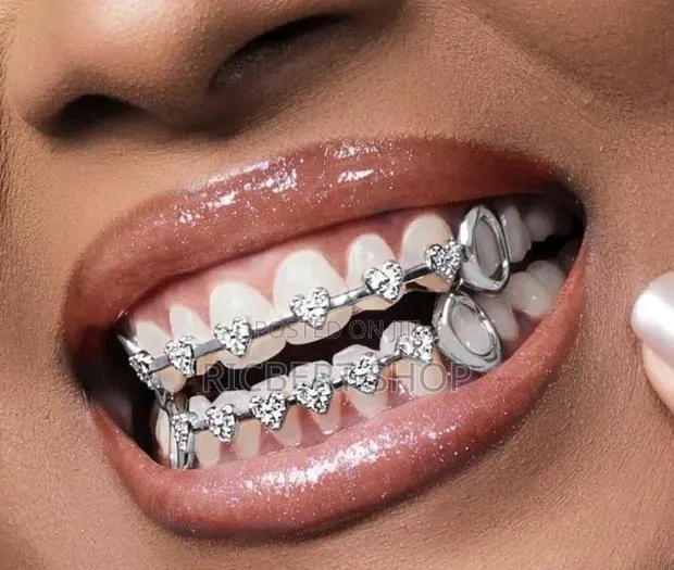 Teeth Grillz Braces · Photo 1