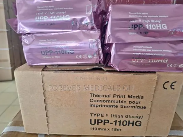 Ultrasound Paper High Glossy (Upp - 110hg) · Photo 1