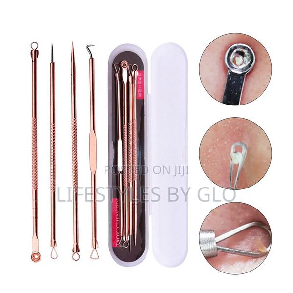 Stainless Steel 4pc Facial Extractor Kit Acne Blemish · Photo 3