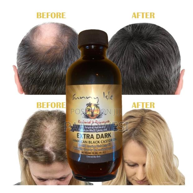 Purely Original Castor Oil for Hair Growth. · Photo 1