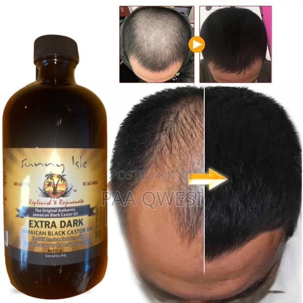 Castor Oil { General Hair Growth Product] · Photo 1