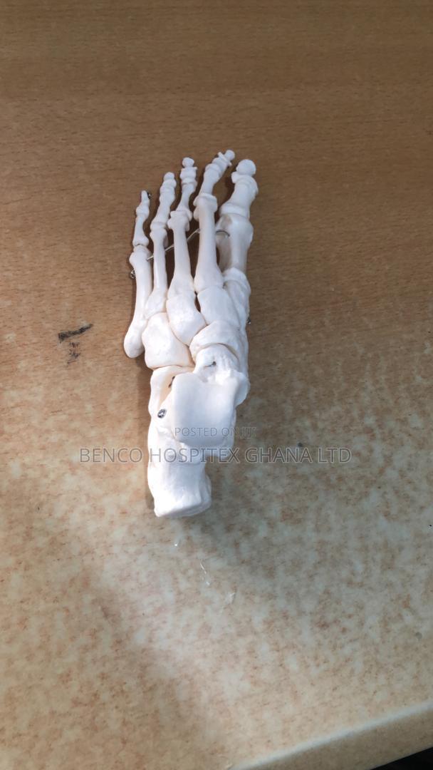 Lower Left Foot Bone · Photo 1