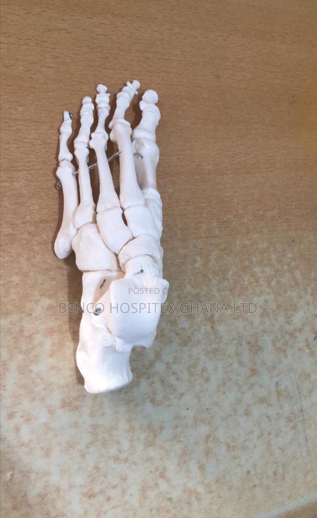 Lower Left Foot Bone · Photo 2