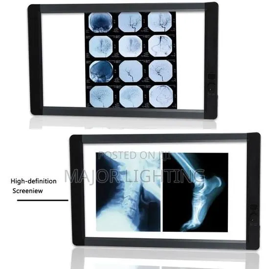 X-Ray View Box Double · Photo 1
