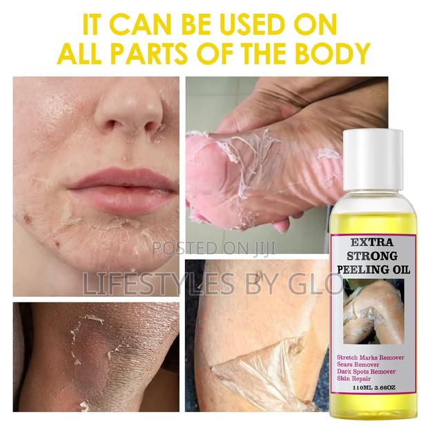 Extra Strong Peeling Oil (Exfoliating Body Oil) · Photo 1
