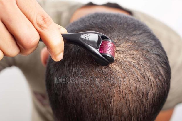 Derma Roller for Growing Hair · Photo 1
