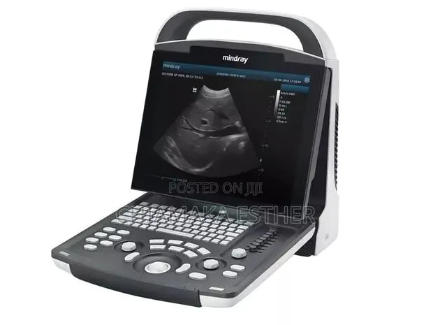 Dp 10 Mindray Scan Machine · Photo 1