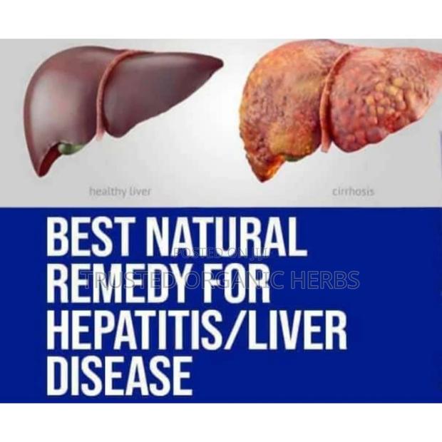 Best Natural Remedy for Hepatitis/ Liver/Kidney Disease · Photo 1