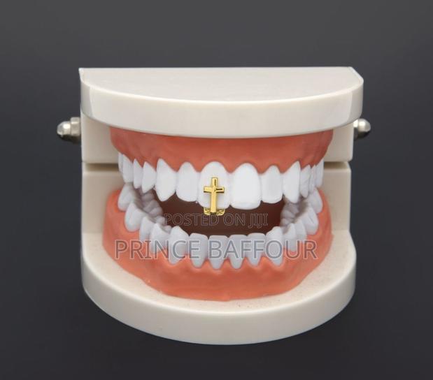 Hip Hop Teeth / Simple Gold Grillz · Photo 3