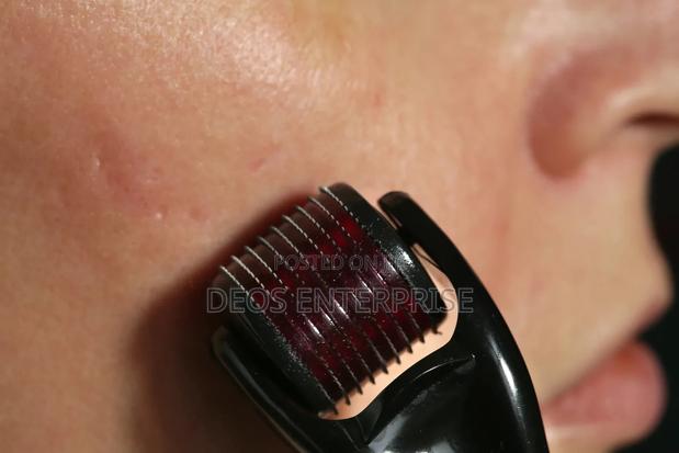 0.5mm Derma Roller for Facial · Photo 1