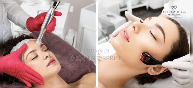 540 Microneedlings of Derma Roller · Photo 1