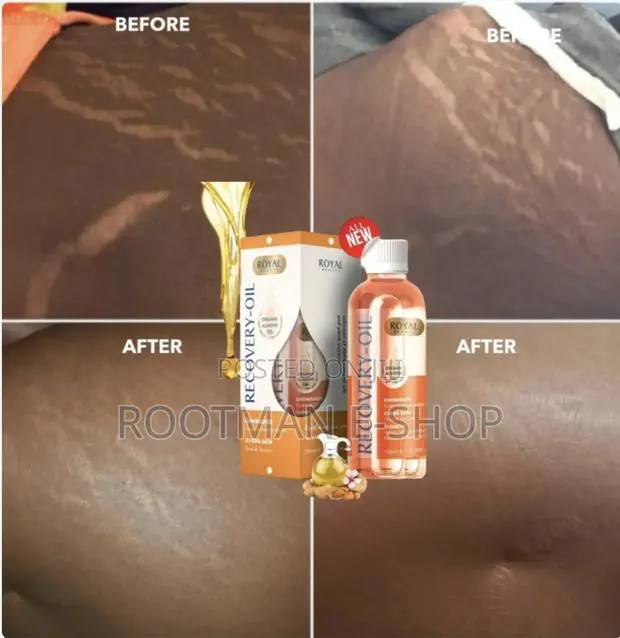 Scares Stretch Marks (Recovery Oil) · Photo 1