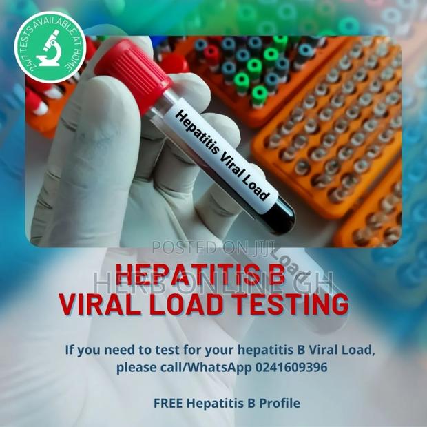 Hepatitis B Viral Load Testing · Photo 1