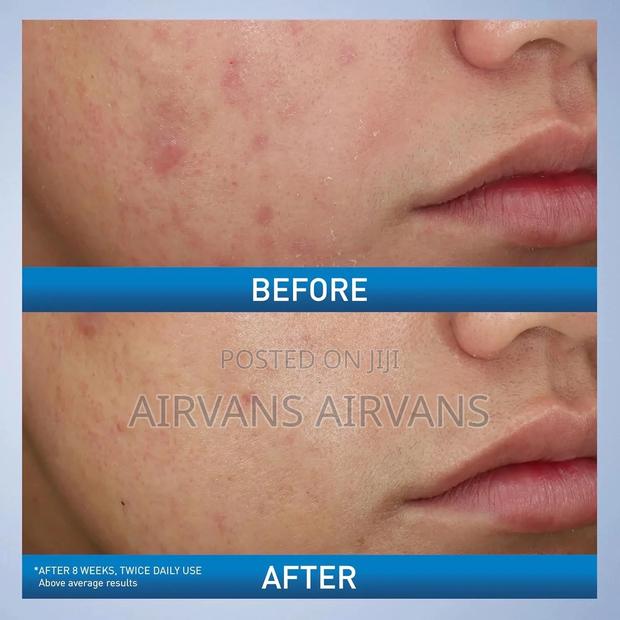 Cerave Acne Foaming Cream Wash · Photo 3