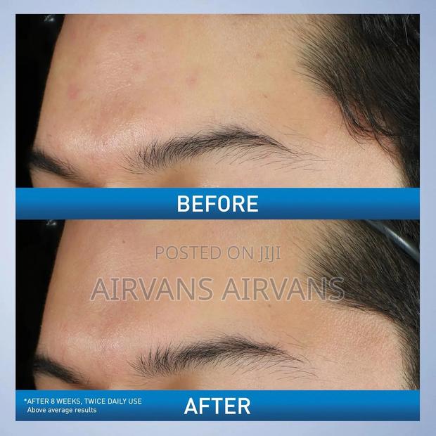 Cerave Acne Foaming Cream Wash · Photo 4