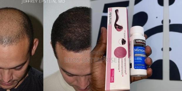 Hair Growth-Kirkland Minoxidil for Baldness Growth · Photo 1