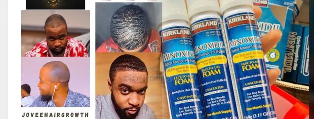 Kirkland Minoxidil Foam for Hair and Baldness Growth · Photo 1