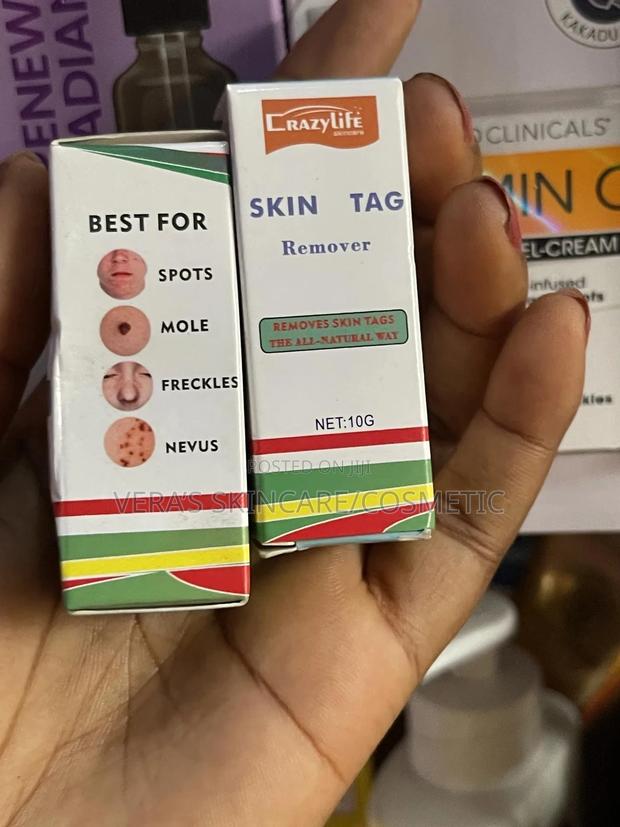 Skin Tag Removal · Photo 1