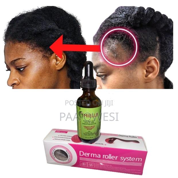 Mielle Rosemary Mint for Hair Growth · Photo 1