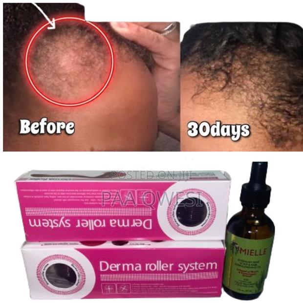 Mielle Derma Roller for Perfect Hair Growth · Photo 1