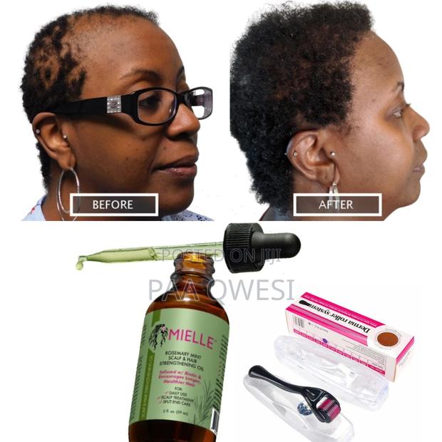Super Hair Growth Combo(Mielle Rosemary Mint Roller) · Photo 1