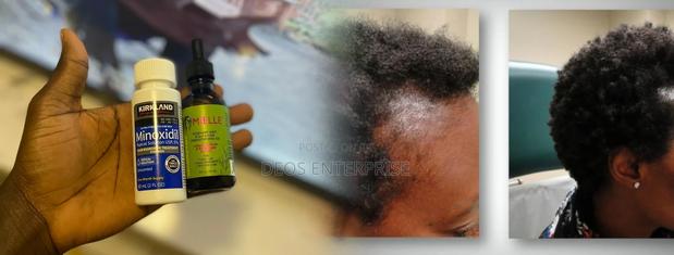 Kirkland Minoxidil Mielle Rosemary Mint for Hair Growth · Photo 1