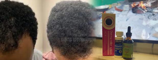 Kirkland Minoxidil Mielle Roller for Hair Baldness · Photo 1