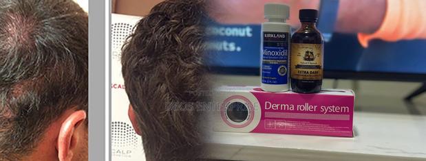 Massive Kirkland Roller Castor Oil for Hair Growth · Photo 1