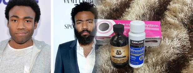 Great Super Combo for Beard Baldness Growth · Photo 1