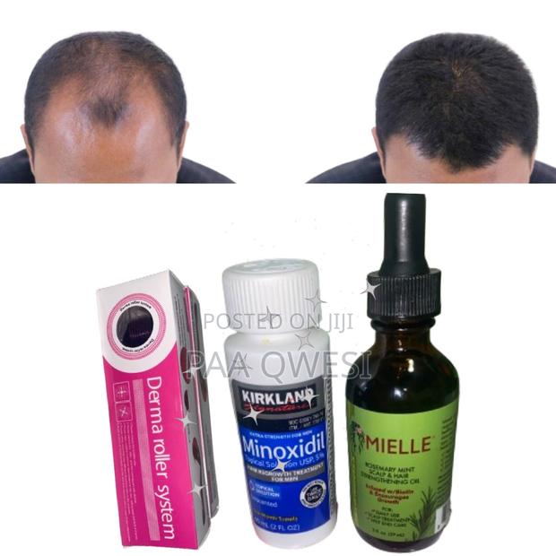 Roller , Kirkland Mielle for Hair Loss Regrowth · Photo 1