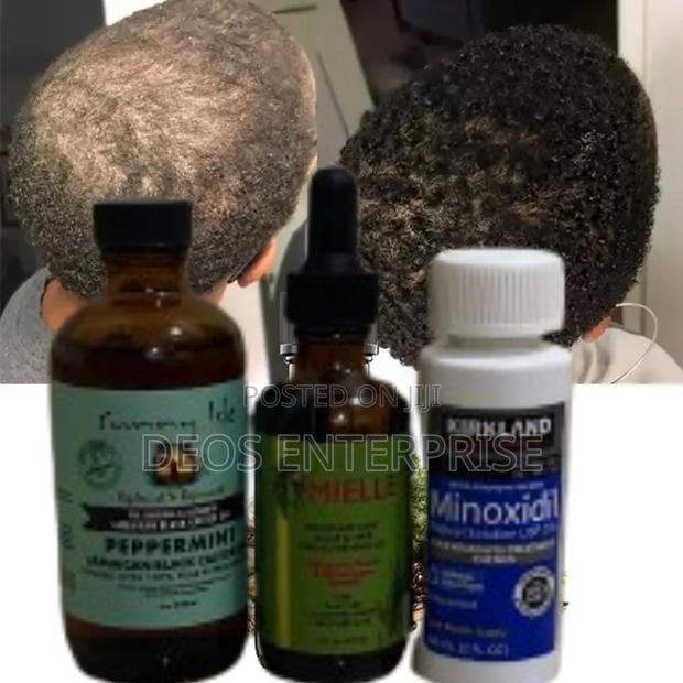 Effective Combo of Kirkland Mielle Peppermint for Hair · Photo 1