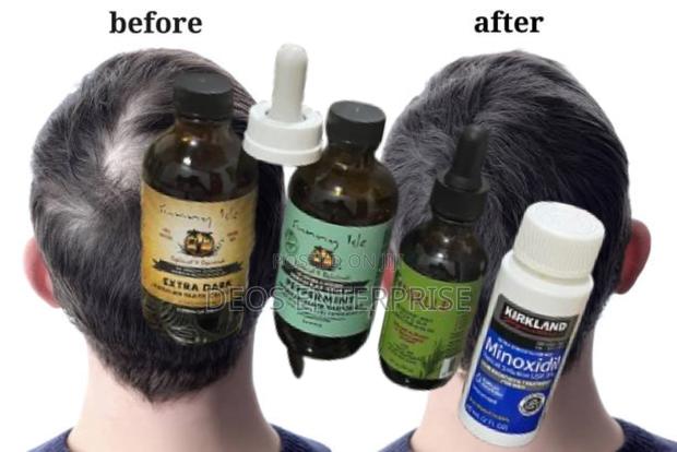 Castor Oil Peppermint Mielle Organics Kirkland · Photo 1