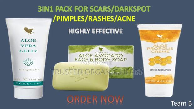 3in1 Pack For Scar/Pimples/Rashes/Acne- Highly Effective · Photo 1