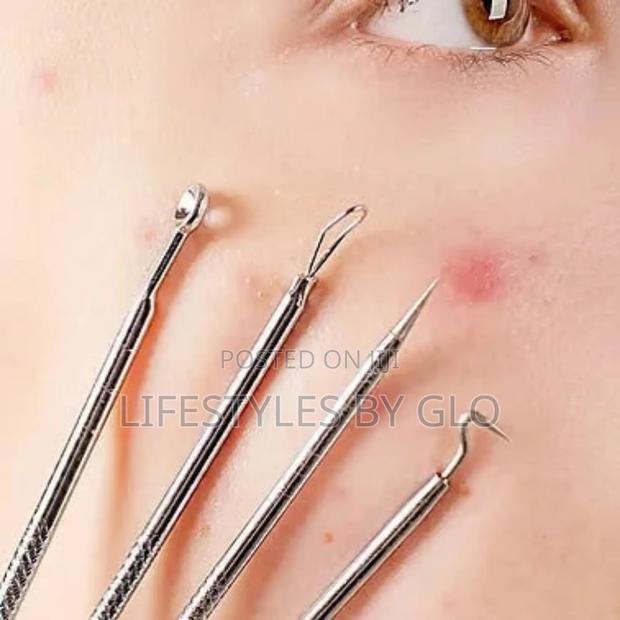 Stainless Steel 4pc Facial Extractor Kit Acne Blemish · Photo 1