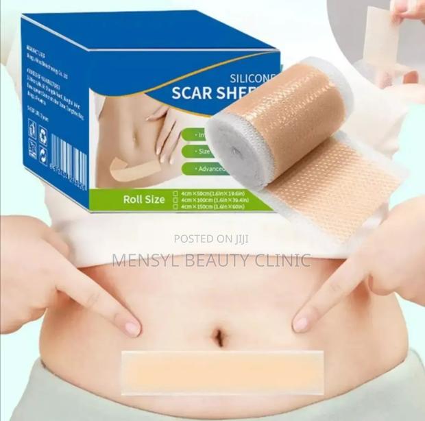 Medical Silicone Scar Reusable Sheet. For Cs, Keloid Surgery · Photo 1