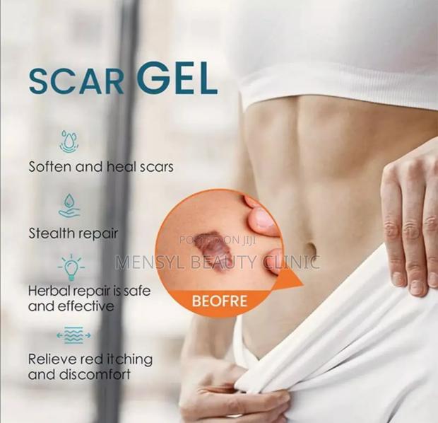Silicone Scar Gel for All Type of Scar Including Keloid · Photo 8