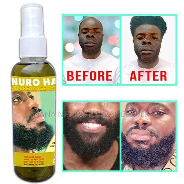 Hair Growth Oil - 100ml ( Nnuro Hair Food ) · Photo 2