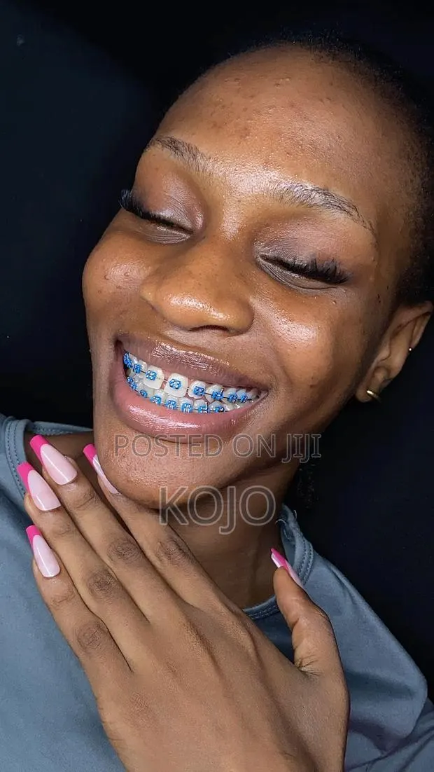 Teeth Braces · Photo 1