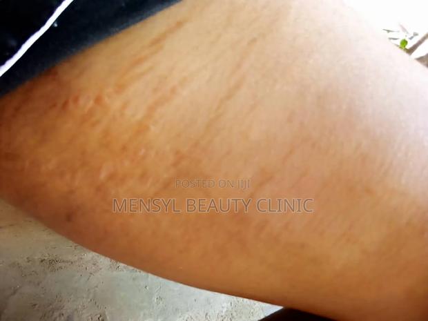 Chemical Peel Gly-Colagen Peeling Solution for Radiant Skin · Photo 8