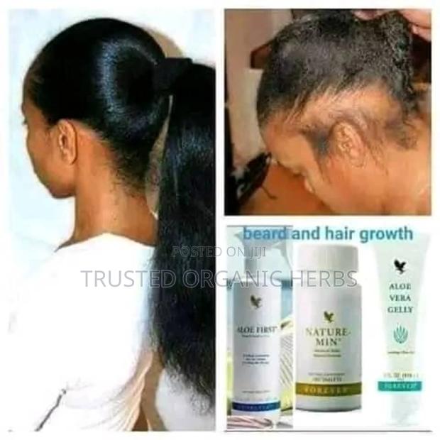 Ladies Hair Growth- Long-Lasting Hair · Photo 1
