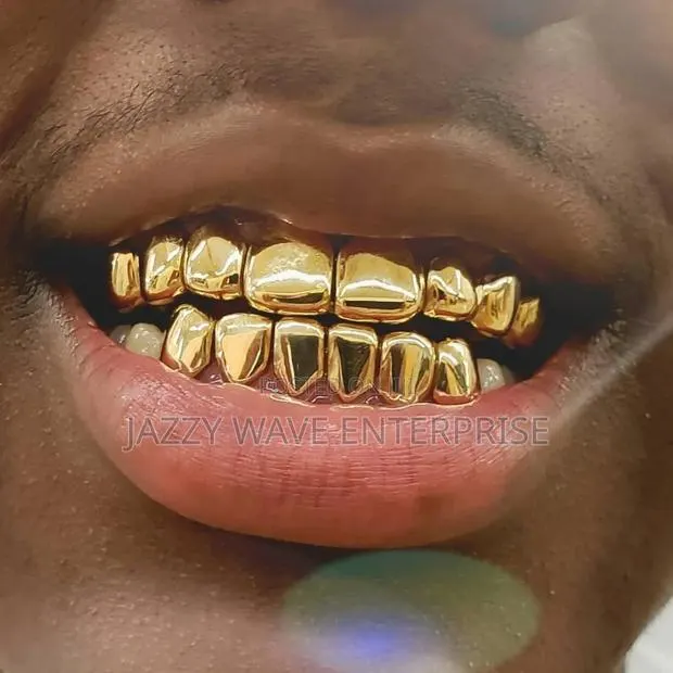 Teeth Grill · Photo 2