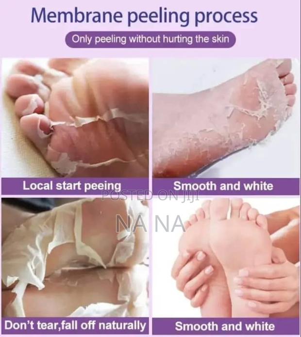 Exfoliating Feet Mask · Photo 7