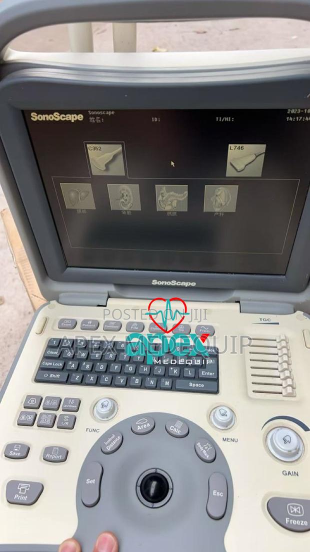 Sonoscape A6 Portable Ultrasound Machine + 2 Probes · Photo 2