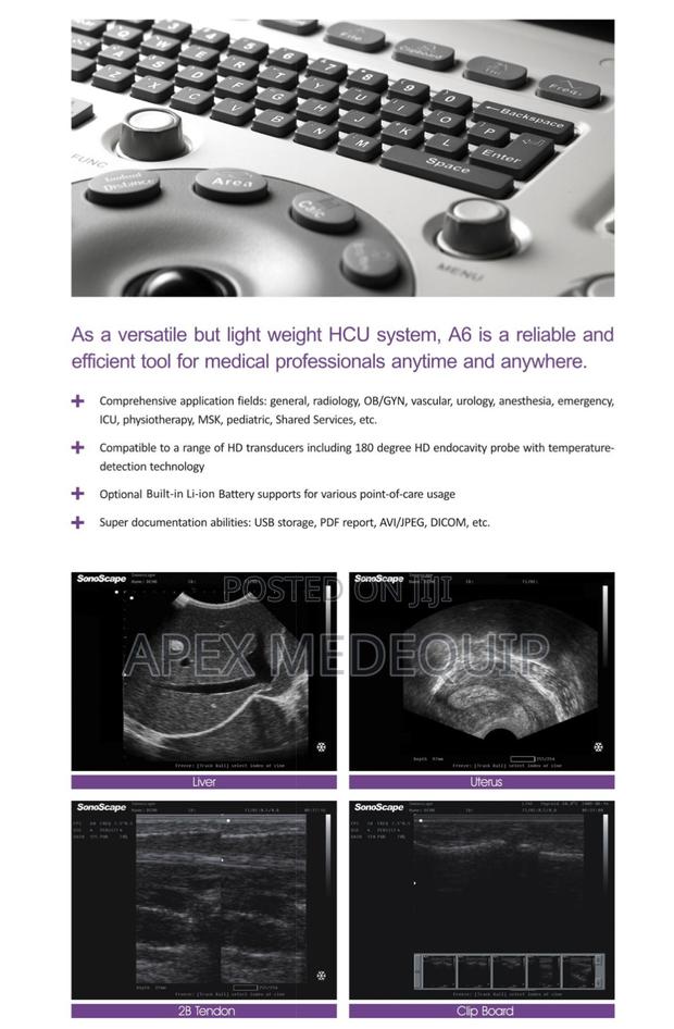 Sonoscape A6 Portable Ultrasound Machine + 2 Probes · Photo 4
