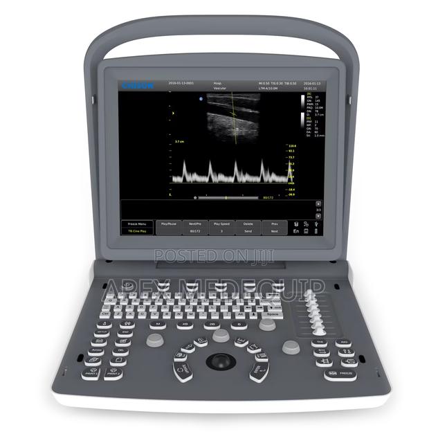 Chison Eco 2 Portable Doppler Ultrasound + Battery · Photo 3